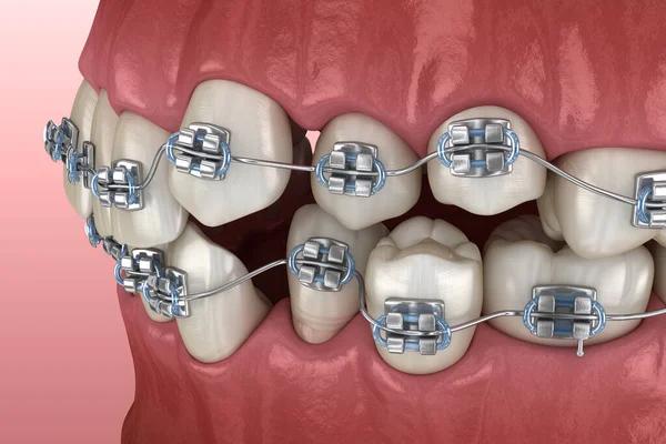 Redefine Your Look Through Cosmetic Dental Solutions
